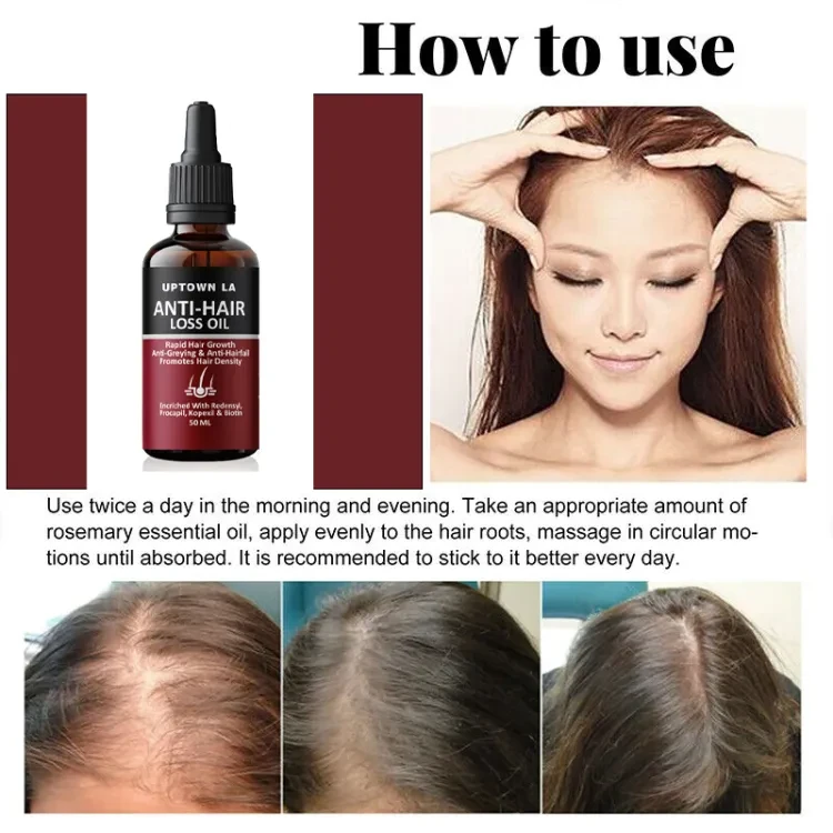 Uptown LA Anti Hair Loss Hair Regrowth Oil 30 Ml